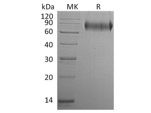 Human E-Selectin/SELE Recombinant Protein (RPES3263)