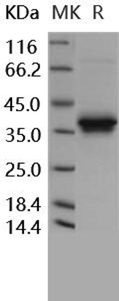 Human FN14/TWEAKR Recombinant Protein (RPES3276)