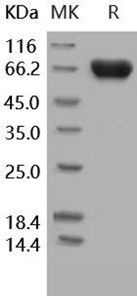 Human TROP2/TACSTD2 Recombinant Protein (RPES3316)