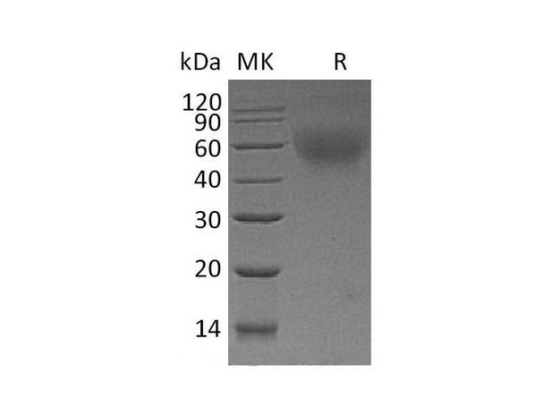 Mouse CD30/TNFRSF8 Recombinant Protein (RPES3348)