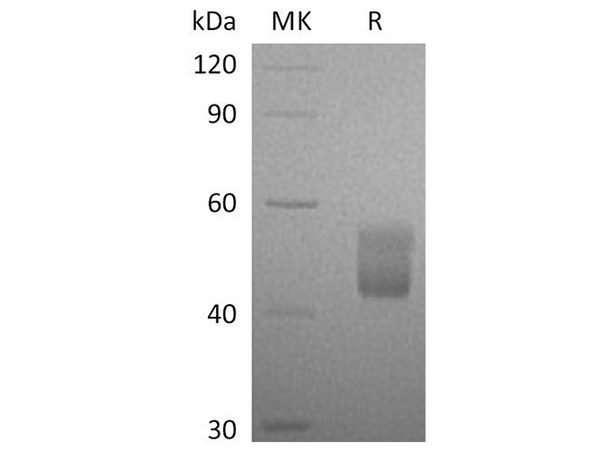 Human CFHR3 Recombinant Protein (RPES3372)