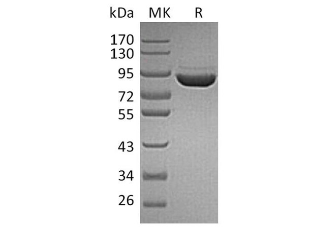 Human F13a/Factor XIIIa Recombinant Protein (RPES3410)