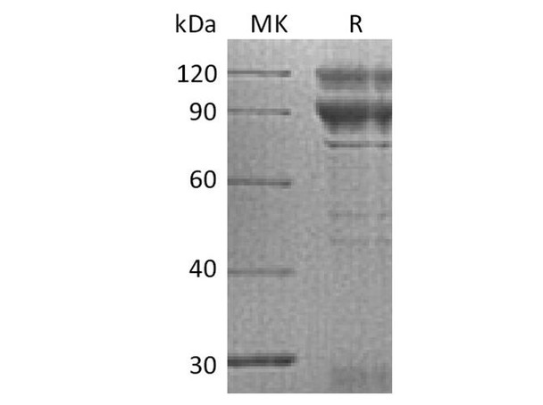 Coagulation Factor X/F10 Recombinant Protein (RPES3430)