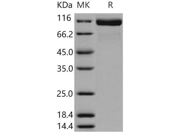 Mouse ACE2 Recombinant Protein (RPES3437)