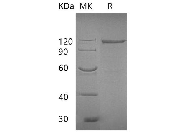 E.coli Beta-galactosidase Recombinant Protein (RPES3494)