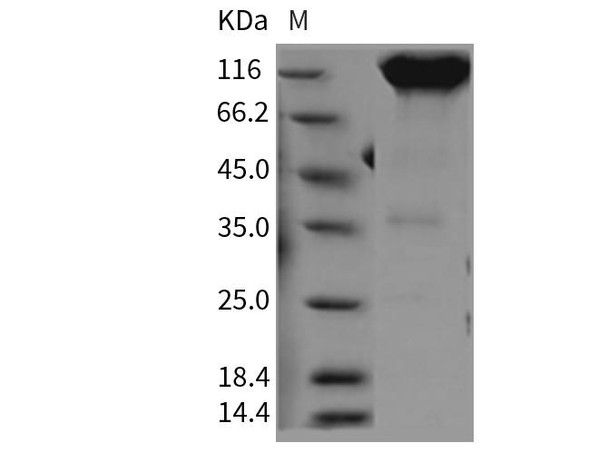 Rat PDGFRa/CD140a Recombinant Protein (RPES3519)