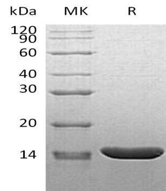 Mouse TNF-alpha/TNFA Recombinant Protein ((RPES3592)