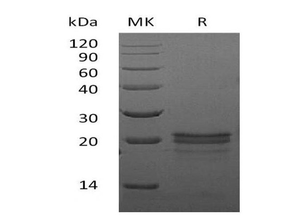Mouse VEGF-A/VEGF164 Recombinant Protein (RPES3678)