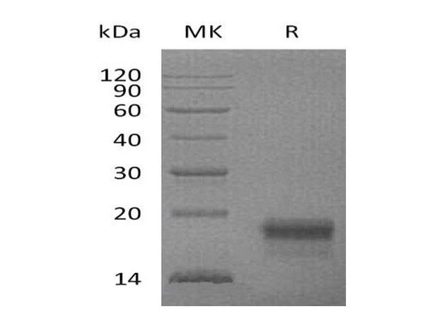 Mouse VEGF-D/VEGFD Recombinant Protein (RPES3700)