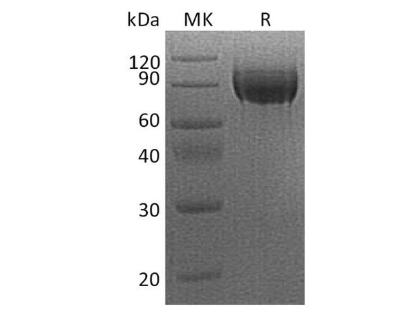 Human VEGFR2/Flk/KDR Recombinant Protein (RPES3747)