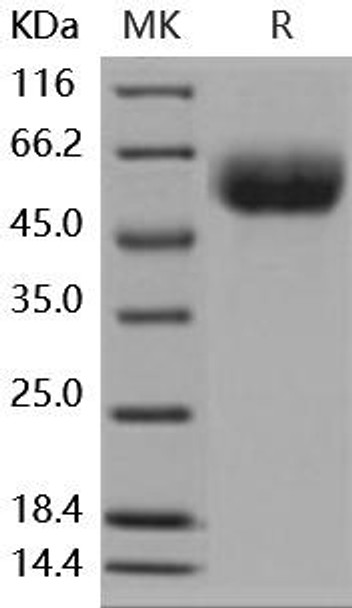 Mouse IL13RA1 Recombinant Protein (RPES3848)