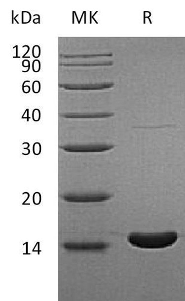 Human RBP5 Recombinant Protein (RPES3891)