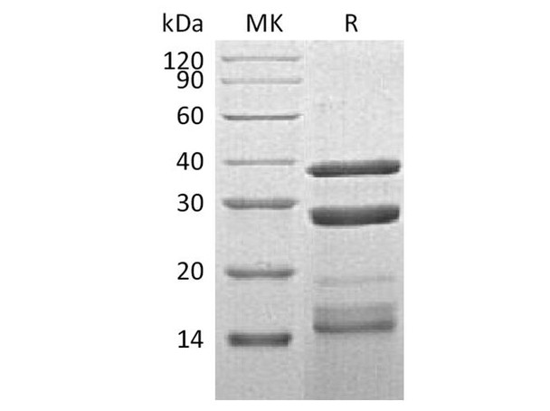 Human Cathepsin S/CTSS Recombinant Protein (RPES3899)