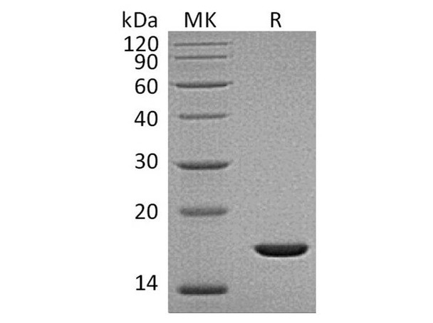 Human FGF-2/FGFb Recombinant Protein (RPES3933)
