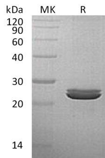 Human LYG2 Recombinant Protein (RPES3976)