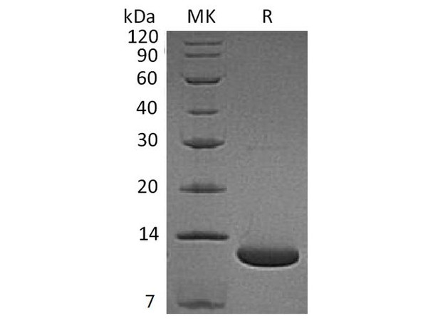 Human Complement C5a Recombinant Protein (RPES4028)