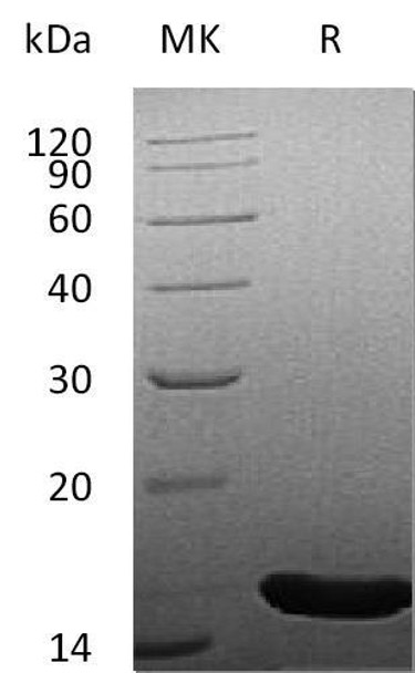 Human FGF-4/FGF4 Recombinant Protein  (RPES4039)