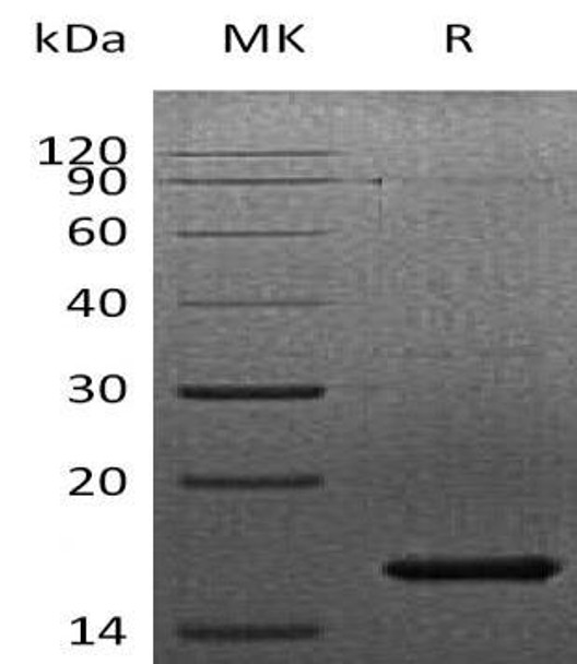 Human FGF-7/KGF Recombinant Protein  (RPES4063)