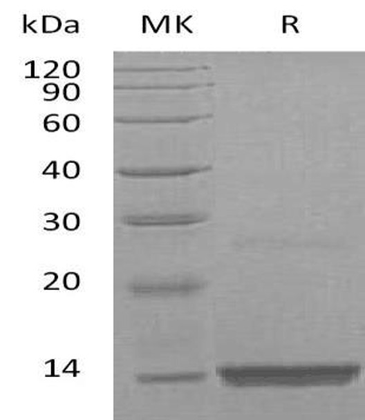 Human FGF-9/FGF9 Recombinant Protein  (RPES4135)