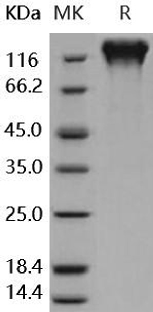 Human CD50/ICAM-3 Recombinant Protein (RPES4247)