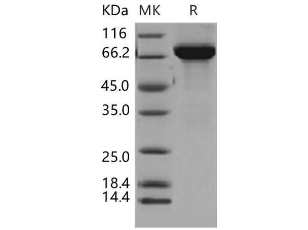 Mouse THOP1 Recombinant Protein (RPES4249)