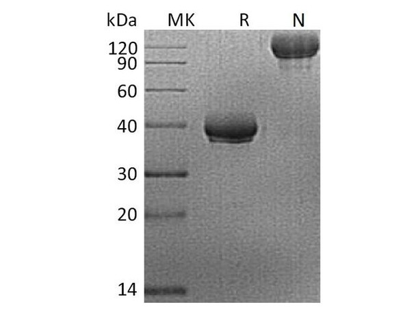 Human BCMA/TNFRSF17 Recombinant Protein (RPES4267)