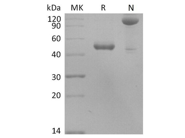 Human BLyS/TNFSF13B/BAFF Recombinant Protein (RPES4340)