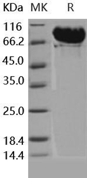 Human MMP-9 Recombinant Protein (RPES4370)