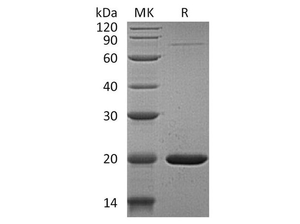 Human GABARAPL1 Recombinant Protein (RPES4444)