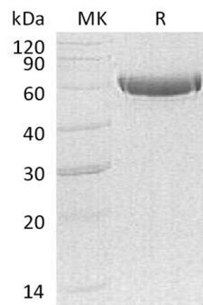 Carboxypeptidase B2/CPB2 Recombinant Protein (RPES4464)