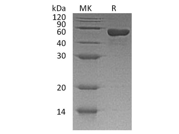 Human CD4/LEU3 Recombinant Protein (RPES4498)