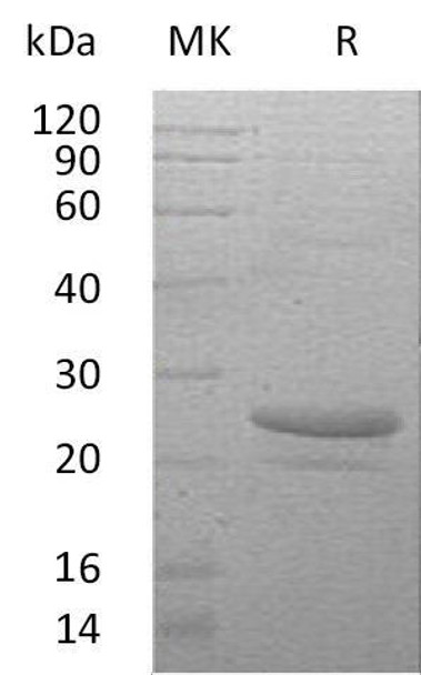 Human Cardiotrophin/CTF1 Recombinant Protein (RPES4529)