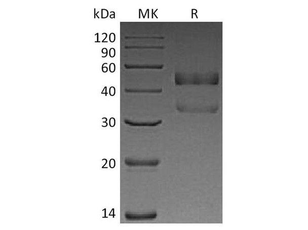 Human ANGPTL7 Recombinant Protein (RPES4583)