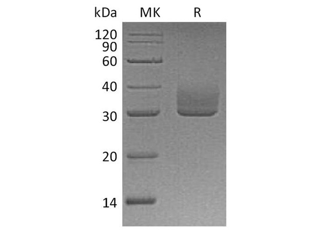 Human ANGPTL3 Recombinant Protein (RPES4603)