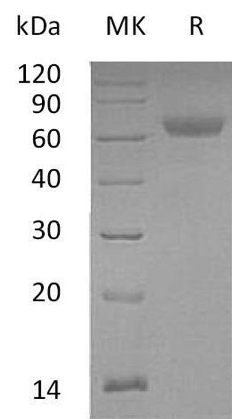 Mouse ANGPTL4 Recombinant Protein (RPES4808)