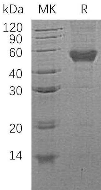 Human CD14 Recombinant Protein (RPES4965)
