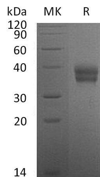 Mouse Carbonic Anhydrase 12 Recombinant Protein (RPES4970)