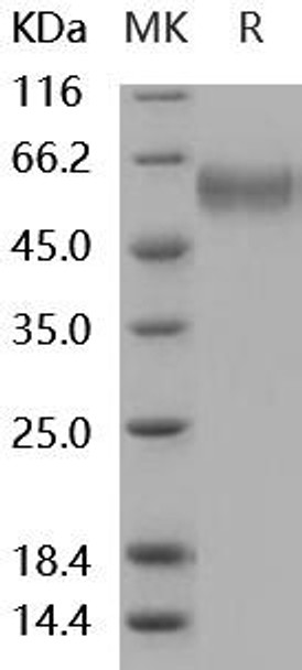 Mouse sFRP4 Recombinant Protein (RPES4983)