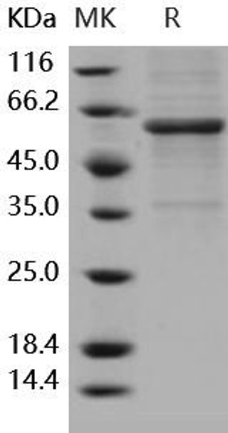 Human METAP1 Recombinant Protein (RPES5025)