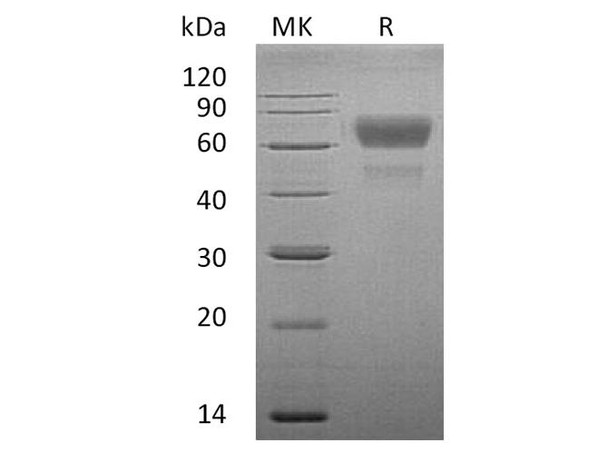 Human CD28/TP44 Recombinant Protein (RPES5104)