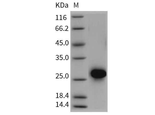 Rat CD40/TNFRSF5 Recombinant Protein (RPES5108)