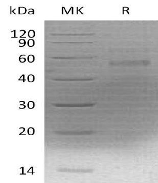 Mouse F10 Recombinant Protein (RPES5250)
