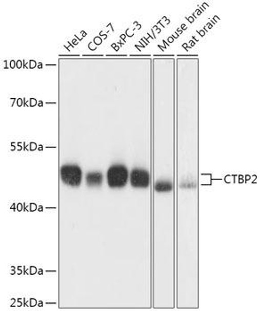 Anti-CTBP2 Antibody (CAB16826)