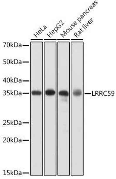 Anti-LRRC59 Antibody (CAB17178)[KO Validated]