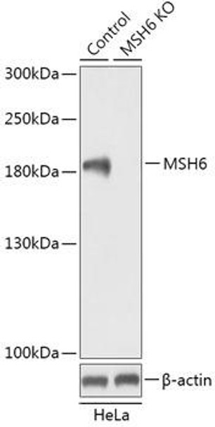 Anti-MSH6 Antibody (CAB18063)[KO Validated]