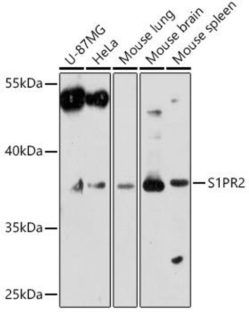 Anti-S1PR2 Antibody (CAB18205)