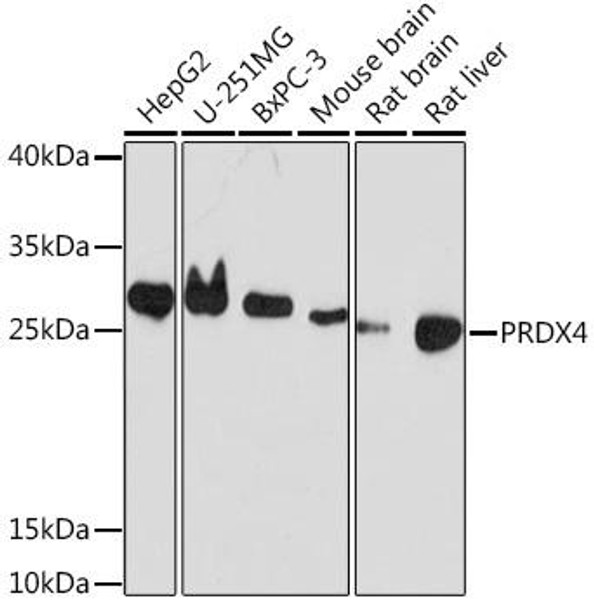 Anti-PRDX4 Antibody (CAB18308) Anti-PRDX4 Antibody (CAB18308)