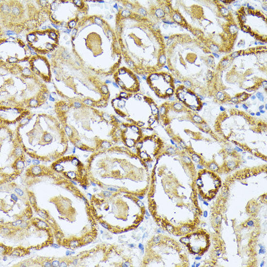 Anti-MT-CO3 Antibody (CAB18318)