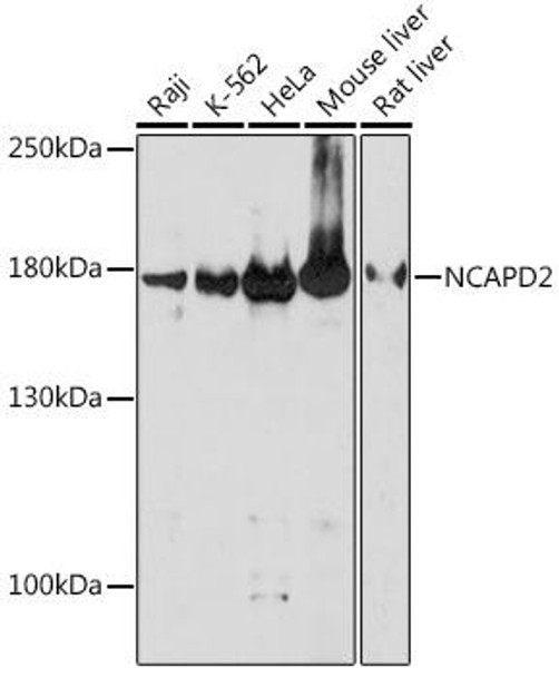 Anti-NCAPD2 Antibody (CAB18412)