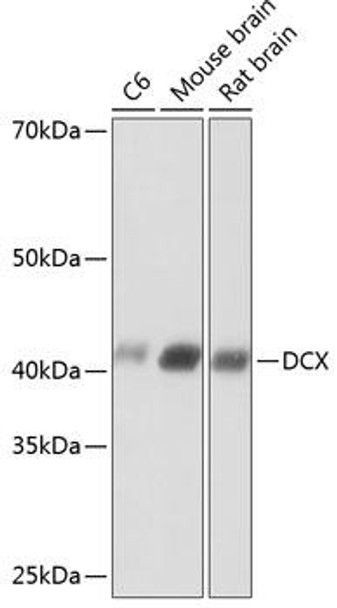 Anti-DCX Antibody (CAB19042)